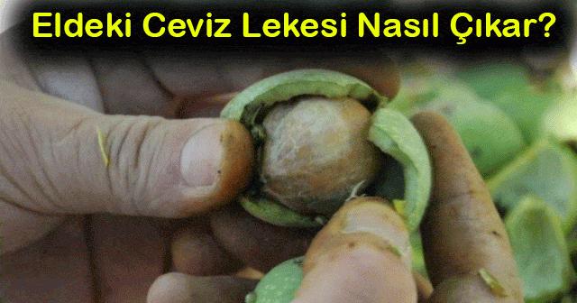 eldeki taze ceviz yesil kabugu lekesi nasil cikar 8 pratik yontem