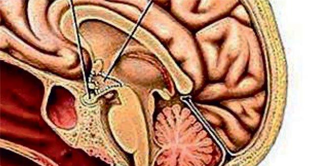 hipotalamus gorevleri ve ozellikleri ne zarar gorurse ne olur