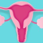 retrovert uterus rahimin arkaya donuk olmasi rahim tersligi nasil duzelir