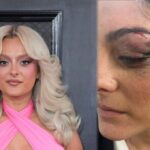 sahnede saldiriya ugrayan bebe rexha son halini paylasti kasina dikis atildi