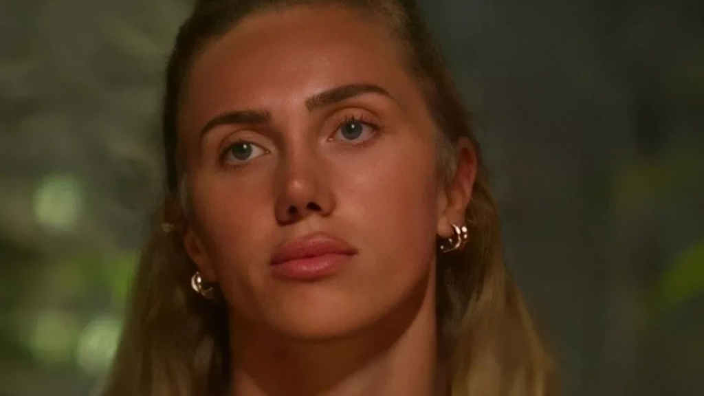 Survivor 2025 Meryem Kasapin estetiksiz hali sosyal medyanin diline dustu Gorenler o olamaz diyor