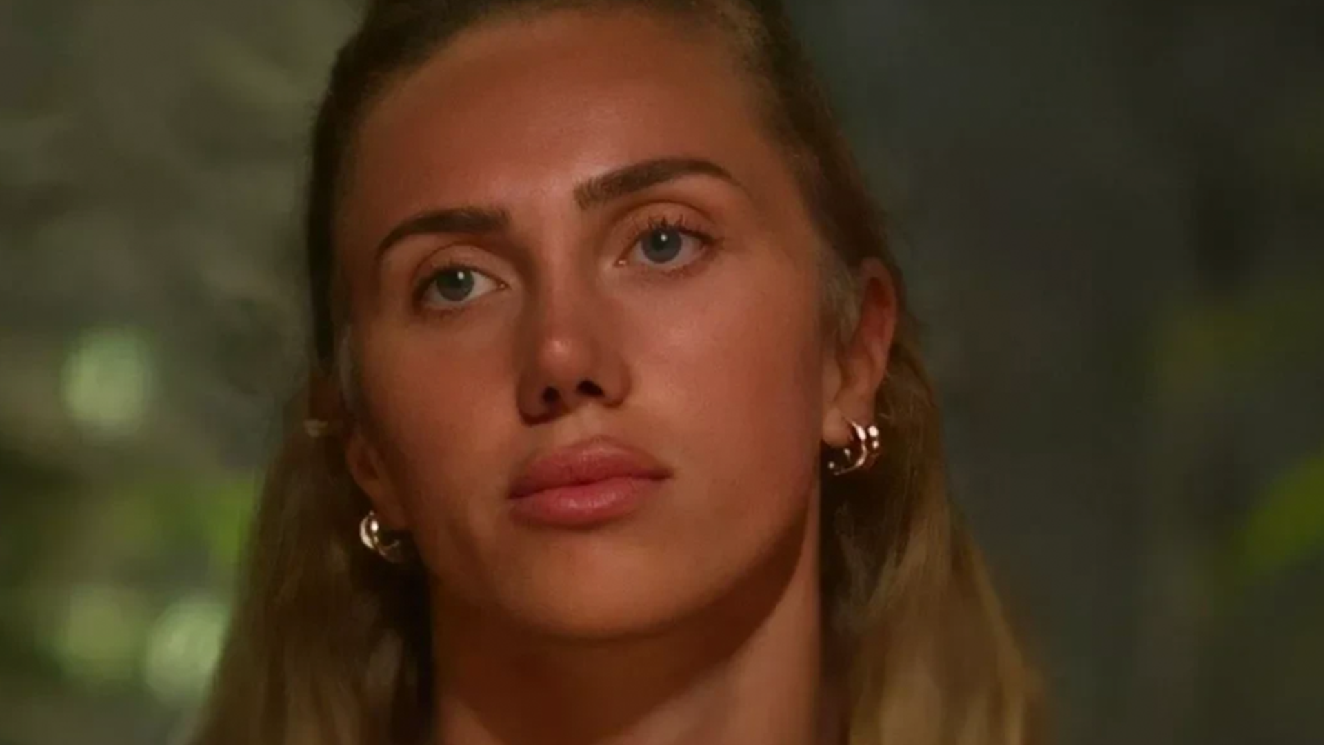 Survivor 2025 Meryem Kasapin estetiksiz hali sosyal medyanin diline dustu Gorenler o olamaz diyor