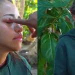 Survivor Zeynep Alkanin gozune ne oldu Tarantula isirdi gozu mosmor oldu