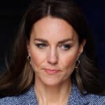 kate middleton kanser tedavisini acikladi bu yontem hastaligi durduruyor