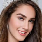 miss turkey2024 guzeli idil bilgen estetik mi oldu bilgen degisimiyle dikkat cekti