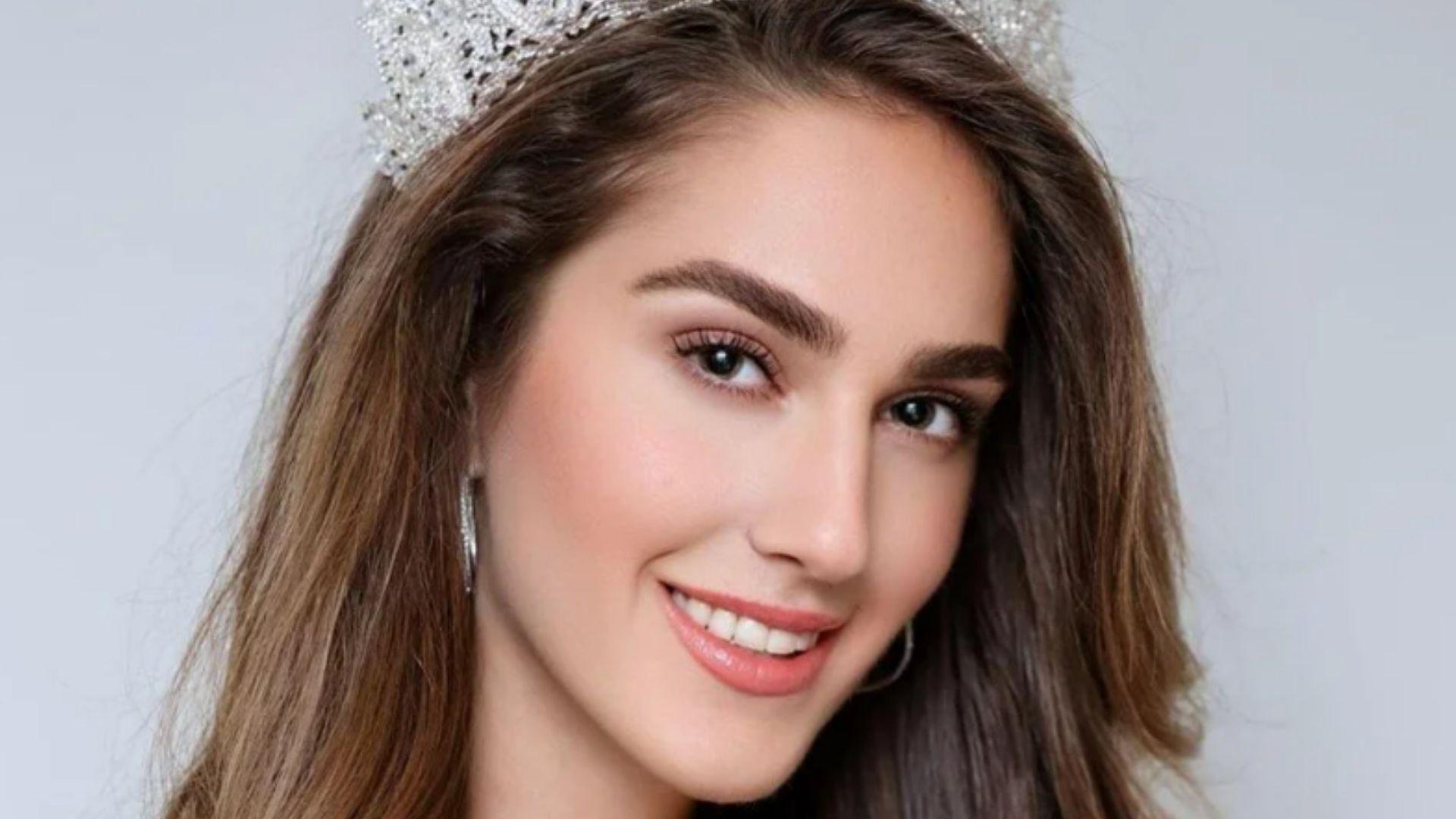 miss turkey2024 guzeli idil bilgen estetik mi oldu bilgen degisimiyle dikkat cekti