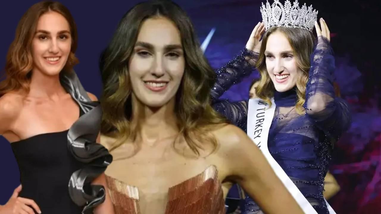 onlarin da sirlari var miss turkey guzeli idil bilgen guzelligini bunlara borclu